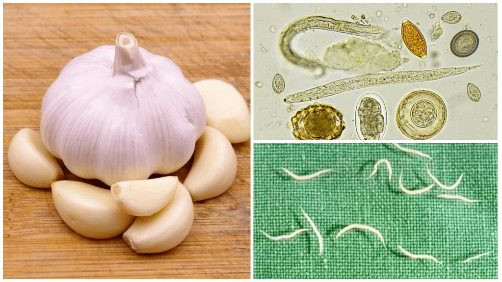 Parásitos en los métodos populares del cuerpo